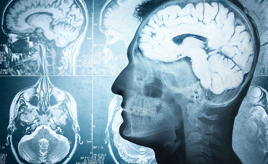 Certificate in Brain Health (Self-Guided)